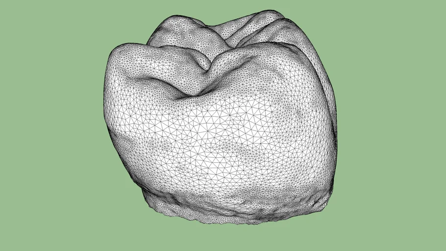 human tooth