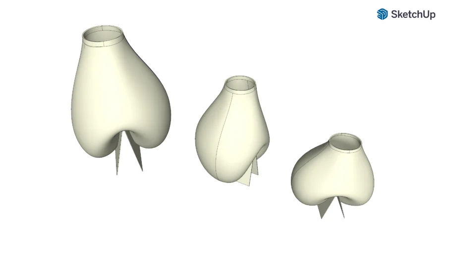 Vasos